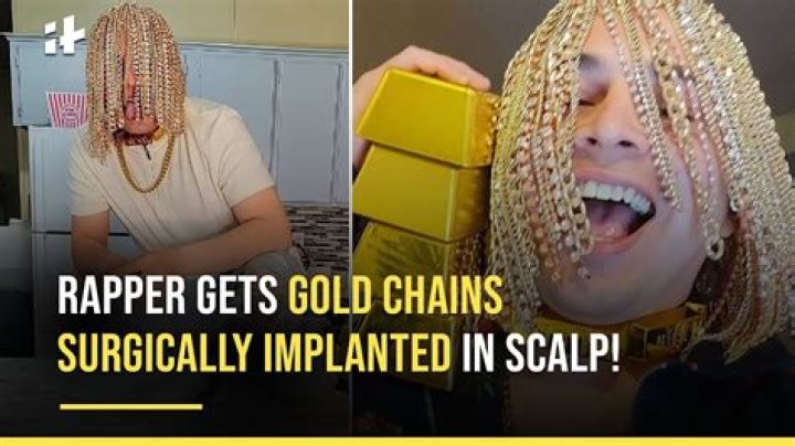 Rapper Dan Sur gets gold chains surgically implanted into scalp