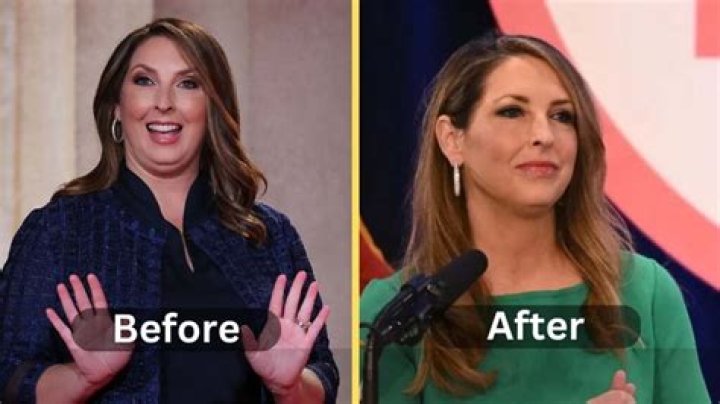 Ronna McDaniel Weight Loss Surgery, Before After & Diet Weight Loss