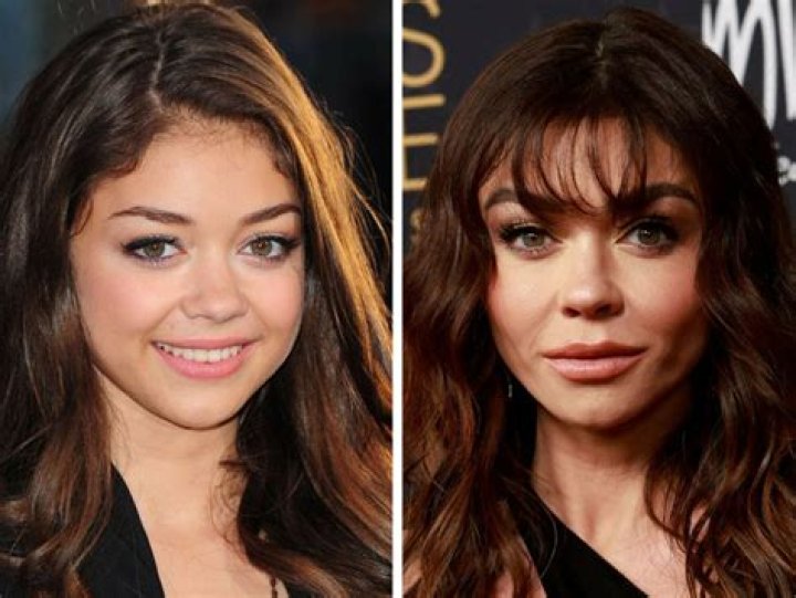 Sarah Hyland Plastic Surgery The Truth Behind Her Transformation