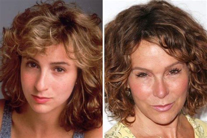 See Jennifer Grey Before and After Plastic Surgery!