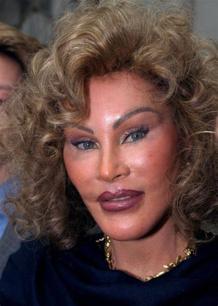See Jocelyn Wildenstein's Shocking Plastic Surgery Transformation Right