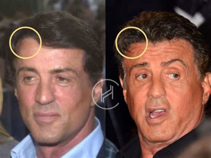 Sylvester Stallone Had to Sleep in Bus Stations & Sell His Dog before