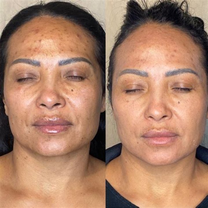 These Before And After Pictures Of Olivia Munn Are Insane What Did She Do To Her Face? Jnews
