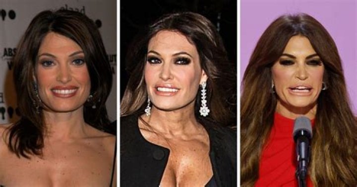 Transformations And Revelations: Kimberly Guilfoyle Before Surgery