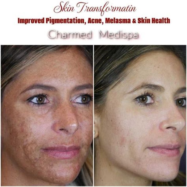 Trust Is Key Charmed Medispa