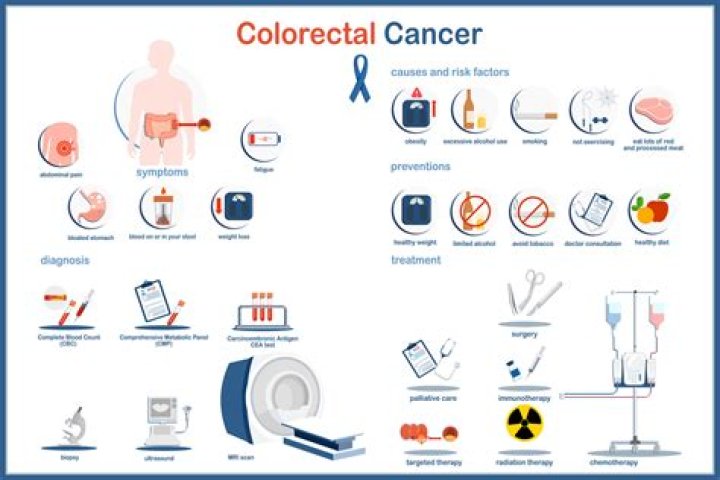 Ultimate Guide To Colorectal Cancer: Prevention, Symptoms, And Treatment