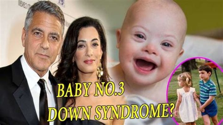 Understanding The Truth Behind George Clooney's Child: Does George Clooney's Child Have Down Syndrome?