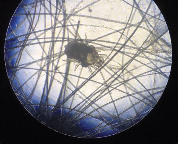 Unraveling Cheyletiella Mites: Discover Their Impact On Human Skin