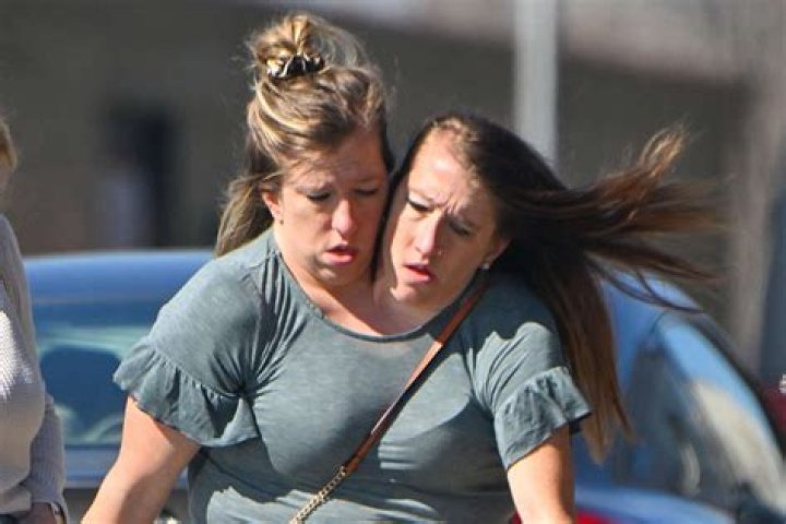 Unraveling The Mystery: Have Abby And Brittany Hensel Died?