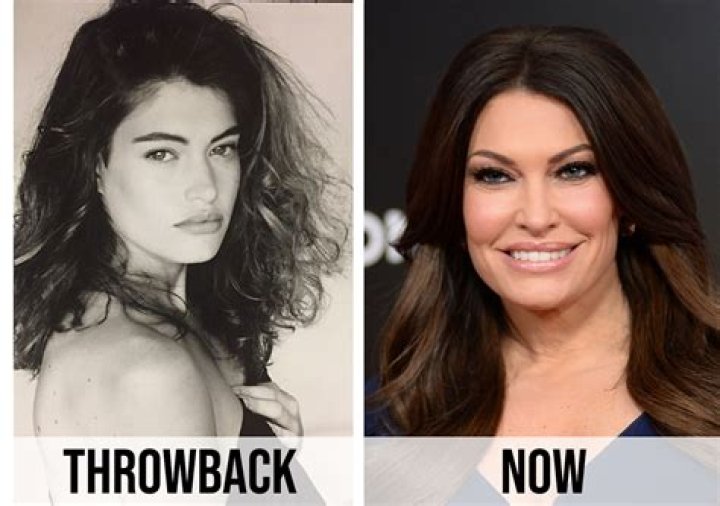 Unveiling The Transformation: What Did Kimberly Guilfoyle Do To Her Face?