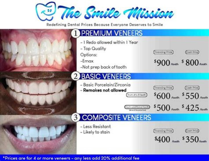 Veneers Can Be Expensive, But They Can Also Be A Good Investment For People Who Want To Improve Their Smile., Gscseven