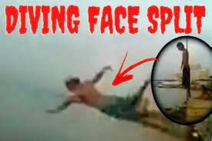 WATCH Face Split Diving Accident Incident Of 2009 Original Video