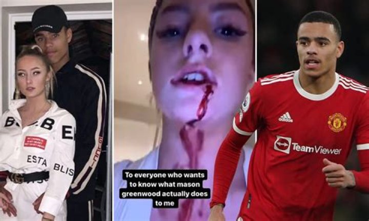 What Happened To Alex Greenwood Face? Injury Details And Family Of The Man City Women Soccer Player