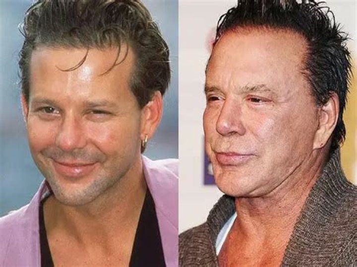 What happened to Mickey Rourke? Face surgery before and after boxing