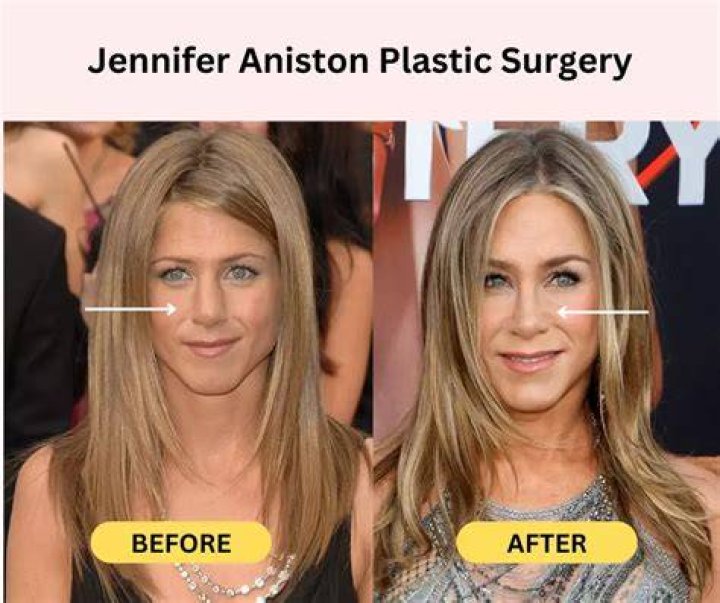 What Plastic Surgery Has Melissa Ordway Gotten? Body Measurements and