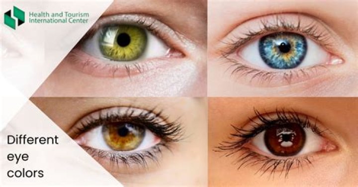 Which eye color is the most common and which is rare? HTI CENTERS