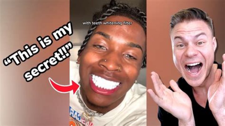 Whitest Teeth In The World