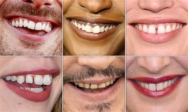 Who has the whitest teeth in the world? Daily Media NG