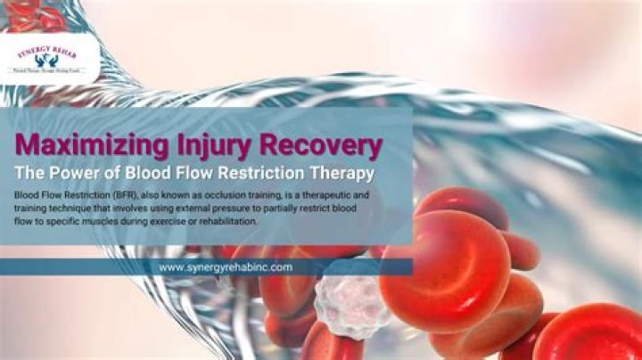 Who Offers Blood Flow Restriction Therapy Philadelphia