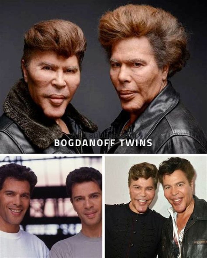 Why did the bogdanoff twins get plastic surgery?