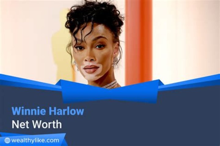 Winnie Harlow Net Worth 2021 The Washington Note