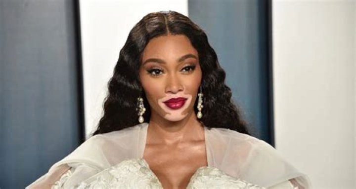 Winnie Harlow Net Worth 2023 The Washington Note