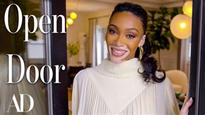Winnie Harlow Net Worth, Age, Bio, Height, Sister, Parents, Skin