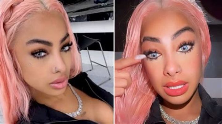 Yailin La M&aacute;s Viral se habr&iacute;a sujetado a una cirug&iacute;a pl&aacute;stica
