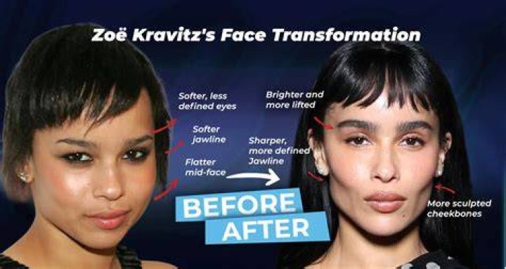 Zo&euml; Isabella Kravitz plastic surgery 27 Celebrity plastic surgery online